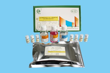 总前列腺特异性抗原(tPSA)定量检测试剂盒（时间分辨荧光免疫分析法）